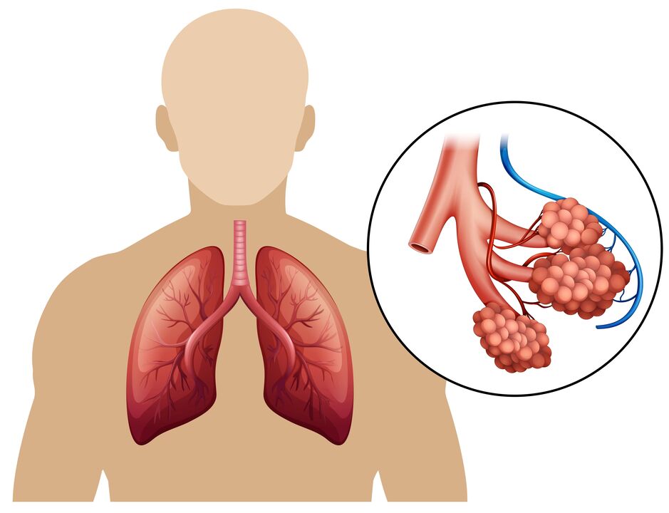 pneumonía e dor entre os omóplatos