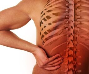 dor de costas con osteocondrose lumbar