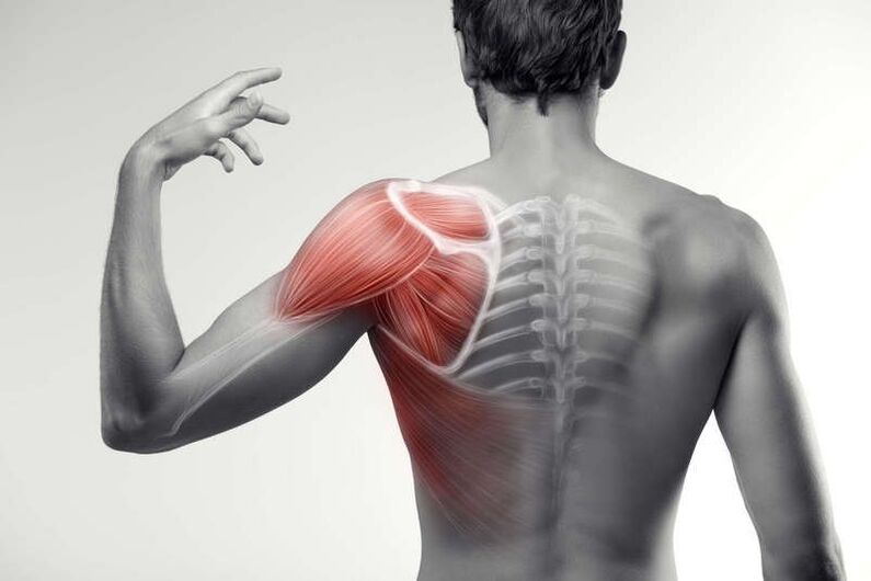 áreas de dor muscular